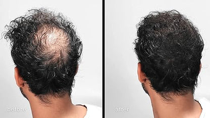 Levins King Hair Building Fiber, Concealer Refill Use For Cabok, Toppik, Looks 21,Regrowth etc. (Black 25+25+25g) Pack of 3