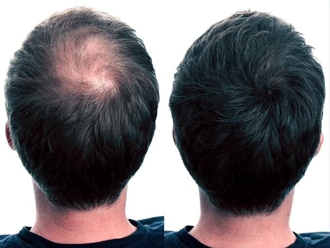 REGROWTH hair Building fibers (Black) 27.5 fiber For Thinning & Bald Spots hair Loss Concealer In Seconds Thickening fibers For Men & Women, 80 Grams
