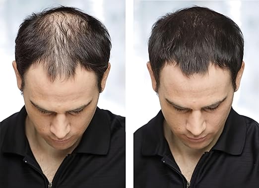 Biosica Hair Building Fibers 27.5Gm - Hair Fibers For Thin & Fine Hair -Hair Thickening Fibers For Men & Women (Black)