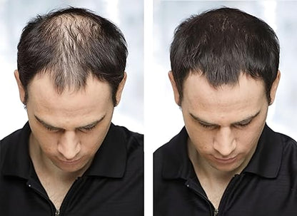 Biosica Hair Building Fibers 27.5Gm - Hair Fibers For Thin & Fine Hair -Hair Thickening Fibers For Men & Women (Black)