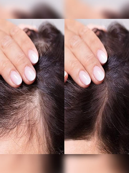 Levins King Hair Building Fiber, Hair fibre Concealer Refill Pack Use For All Hair fiber like Caboki etc (Dark Brown) (Refill Pack of 2 (50g))