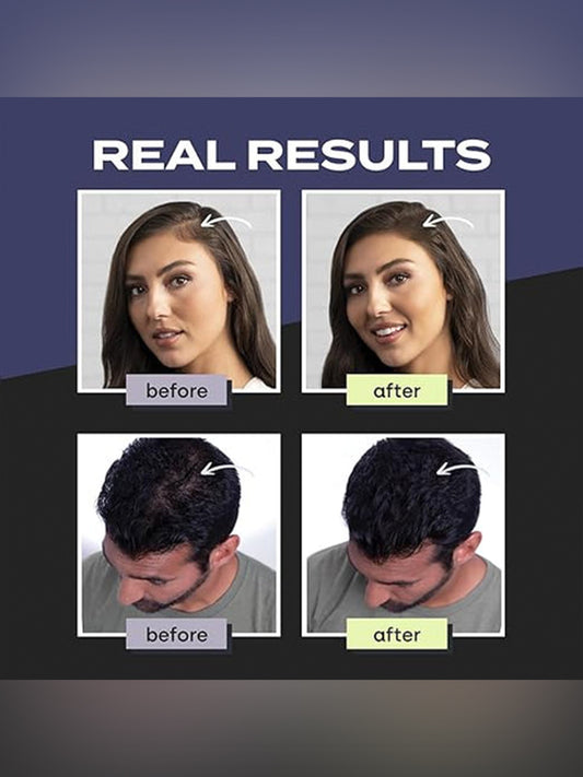 Premium Toppik Hair Building Fibers, Black, 27.5g, Instant Hair Thickening Solution, Fill In Fine or Thinning Hair Instantly Thicker, Fuller Looking Hair (Black, Large1)